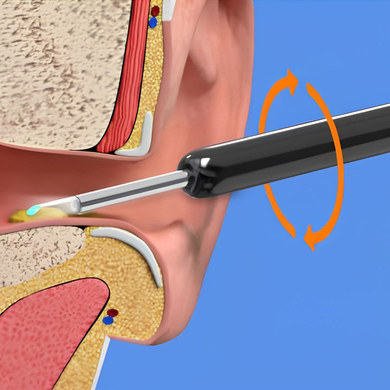 Smart Ear Cleaner